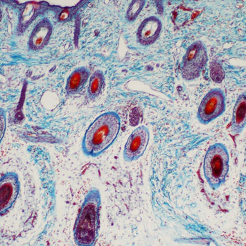 What Happens To Your Cells As You Age - Pt. 3